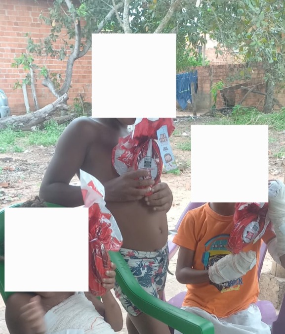 Família desesperada pede ajuda para crianças que foram queimadas