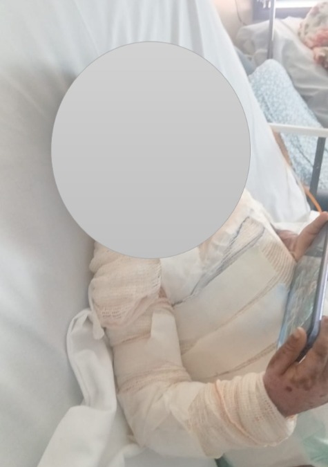 Criança, que foi queimada pelo irmão, morre após mais de 60 dias internada