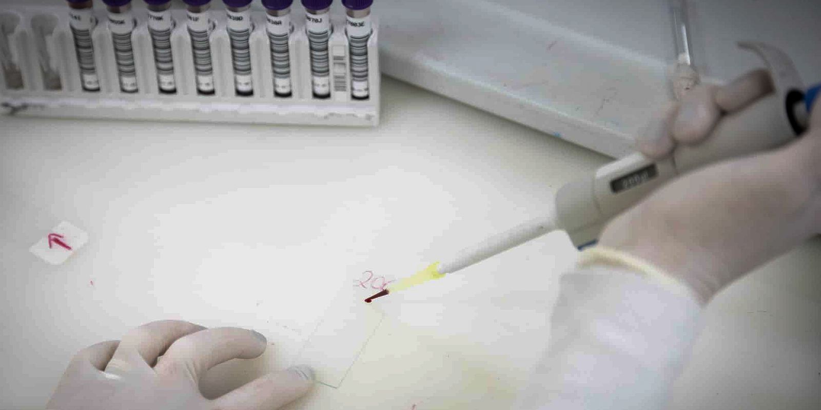 Secretaria de Saúde de SP investiga novo caso suspeito de ebola